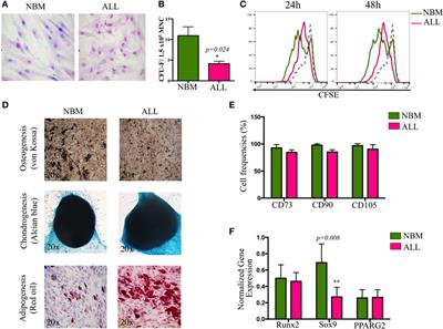 Pro-inflammatory-Related Loss of CXCL12 Niche Promotes Acute Lymphoblastic Leukemic Progression at the Expense of Normal Lymphopoiesis